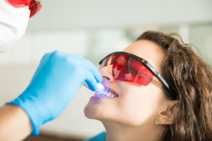 Laser Cavity Removal: What Patients Should Know
